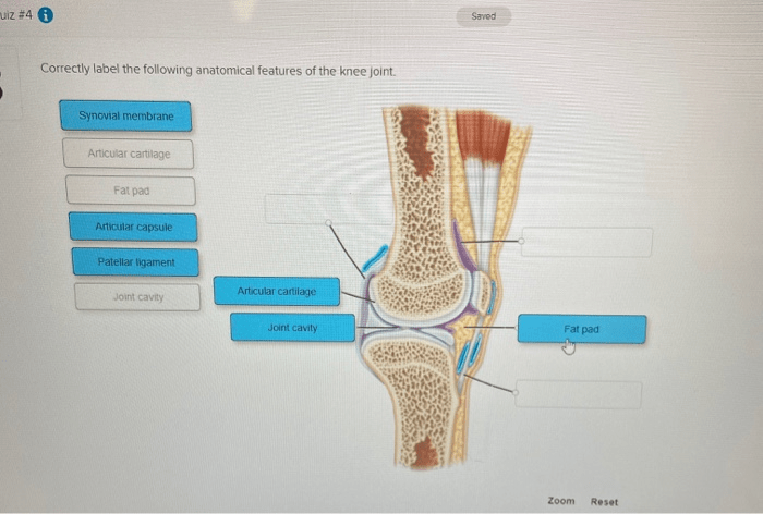 Correctly label the following anatomical parts of the glenohumeral joint